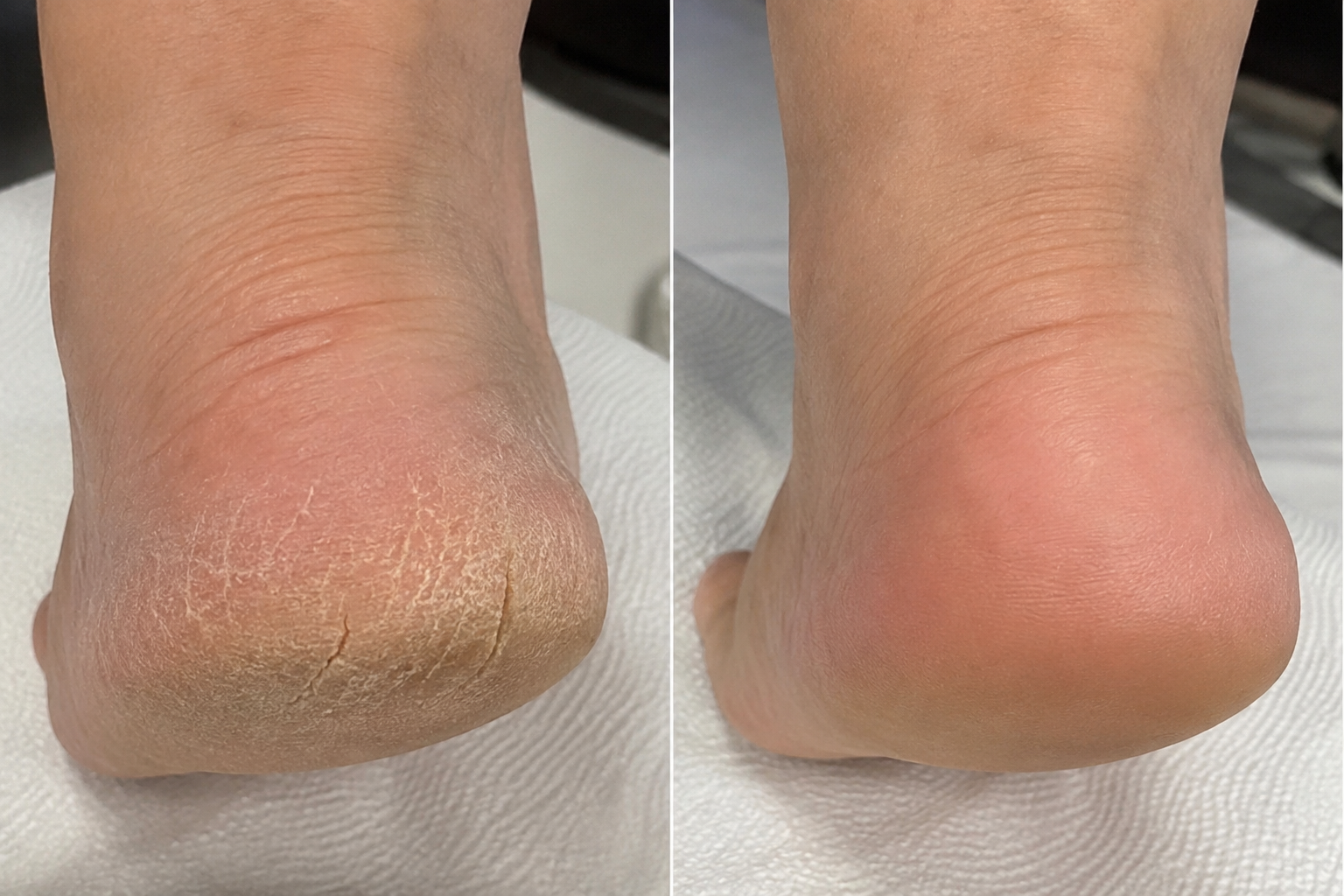 Before and after podiatry