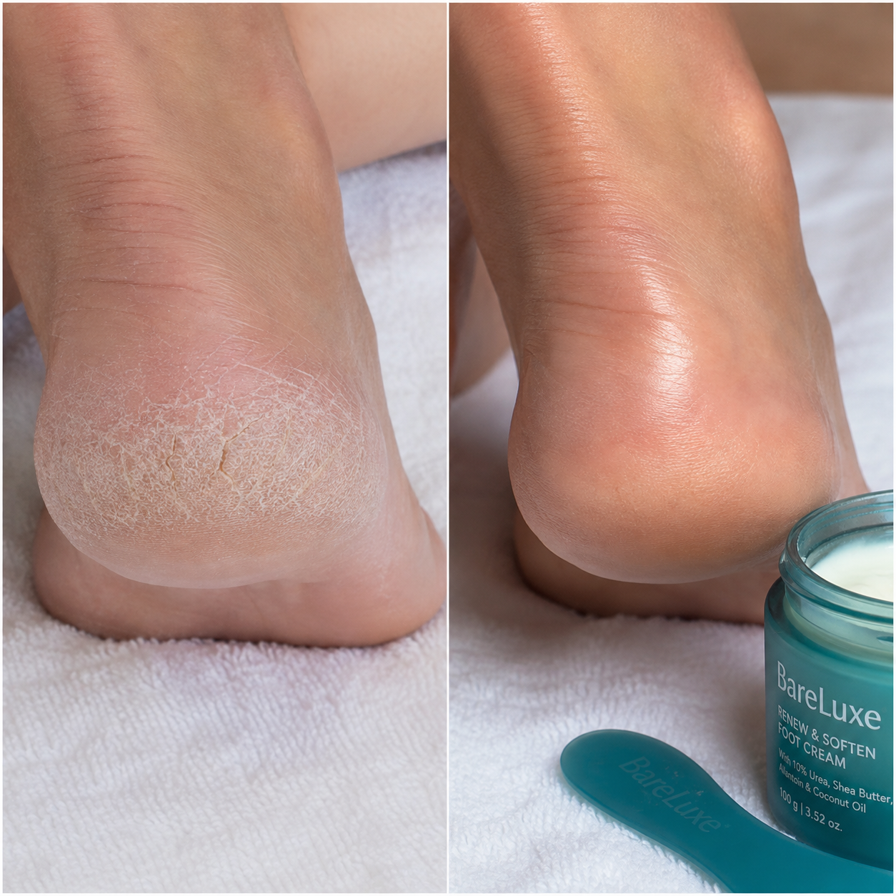 Insoles & Everyday Support images